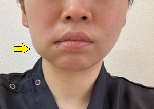 親知らず