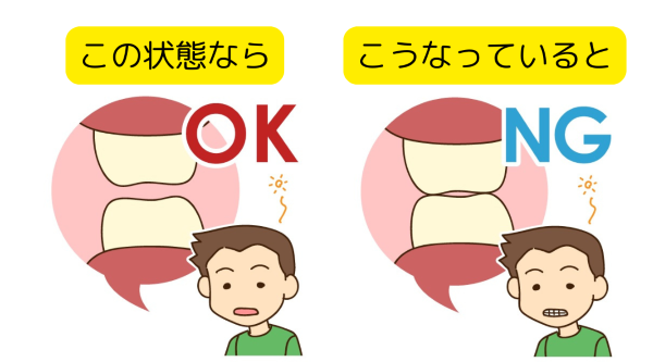 上下の歯　接触