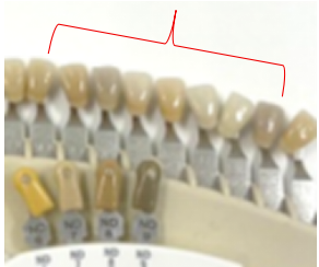 ホームホワイトニングのキット